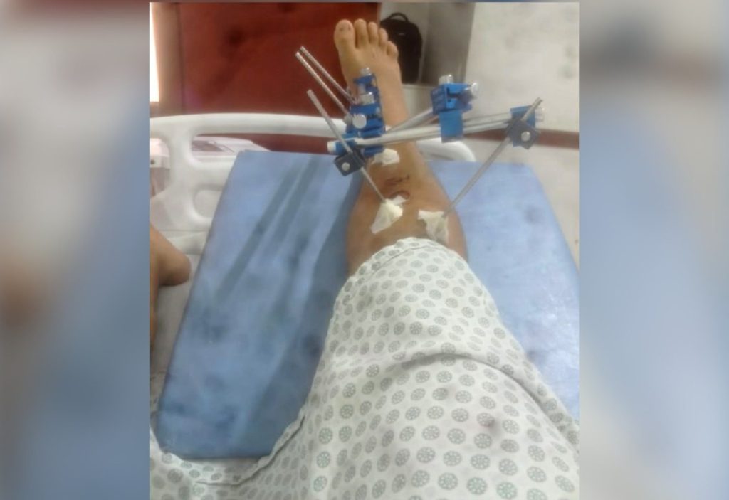 Jovem denuncia ter sido agredido por PMs durante abordagem e dentro de hospital no TO